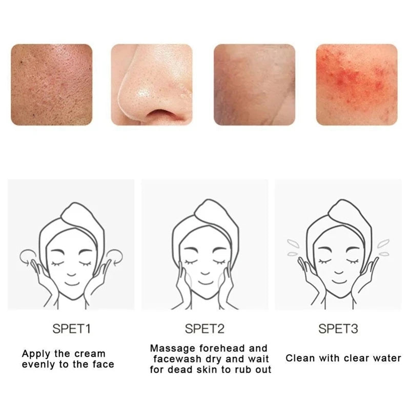 ✨ Gel Esfoliante Facial Ácidos de Fruta – Poros Invisíveis, Pele Lisa e Iluminada
